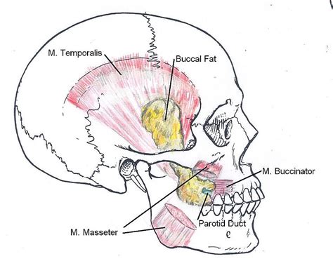 bichats fettpute|Buccal fat pad .